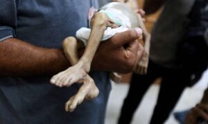 Read more about the article الكيان يحاول تبرير تجويع أطفال غزة بذرائع مريضة ومنحطة