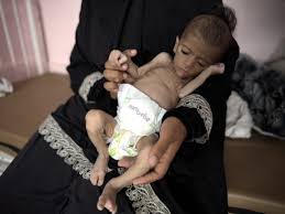 Read more about the article غزة: 217 شهيداً بالتجويع بينهم 100 طفل منذ بدء حرب الإبادة