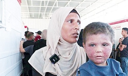 You are currently viewing ضحايا غزة غير المرئيين… على هامش الحرب ونتائجها