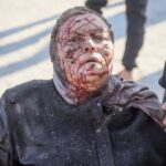 صورة هزت العالم.. ماذا جرى مع الحاجة “مرتجى” على شاطئ غزة بعد أن تحولت “نُزهة” إلى جحيم بسبب صاروخ